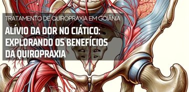 Alívio da Dor no Ciático 2024 Tratamento de Quiropraxia em Goiânia