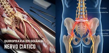O Tratamento de Quiropraxia em Goiânia que Funciona
