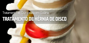 TRATAMENTO DE HÉRNIA DE DISCO
