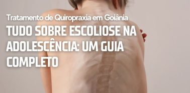 Tudo Sobre Escoliose na Adolescência: Um Guia Completo
